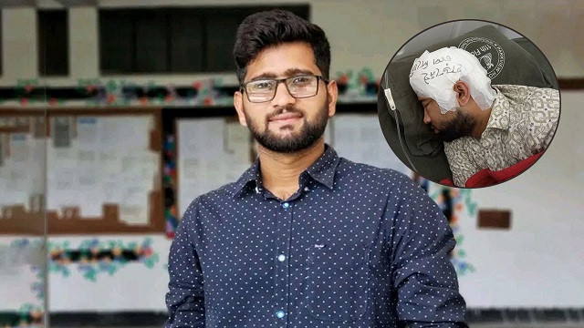 মামুনের খুলি ফ্রিজে, মাথার ব্যান্ডেজ লেখা ‘হাড় নেই, চাপ দিবেন না’