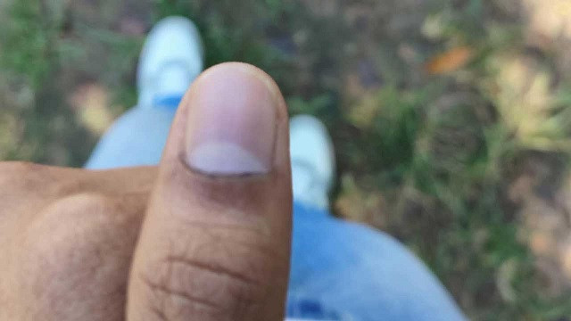 চাকসু নির্বাচন : মুছে যাচ্ছে কালি, অভিযোগ দেবে ছাত্রদল