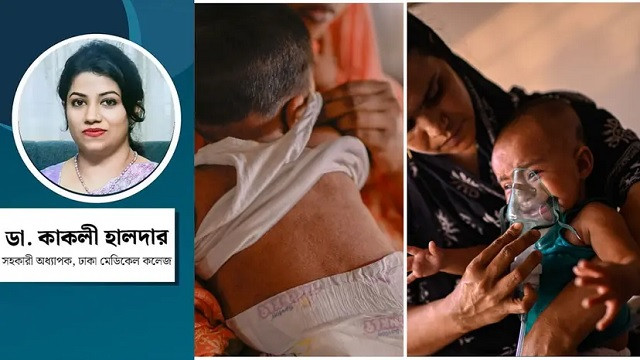 ছবি : সংগৃহীত