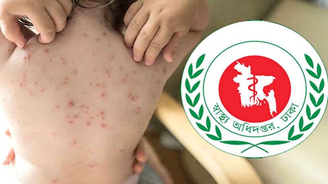 একমাসে হাম ও হাম সন্দেহে ১৯৮ শিশুর মৃত্যু