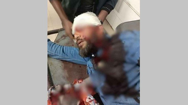 ছবি : সংগৃহীত