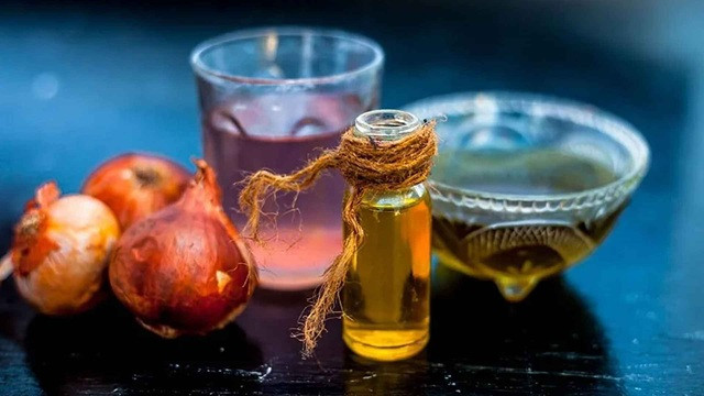 পেঁয়াজের রস নাকি তেল— চুল গজাতে কোনটি বেশি উপকারি?