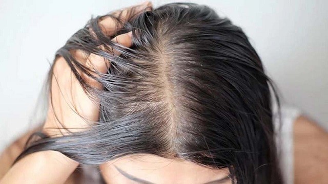 মাথার ত্বকের সমস্যা দূর করার ঘরোয়া উপায়
