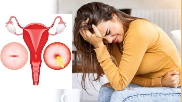 জরায়ু ফাইব্রয়েড রোগীদের কী খাওয়া উচিত